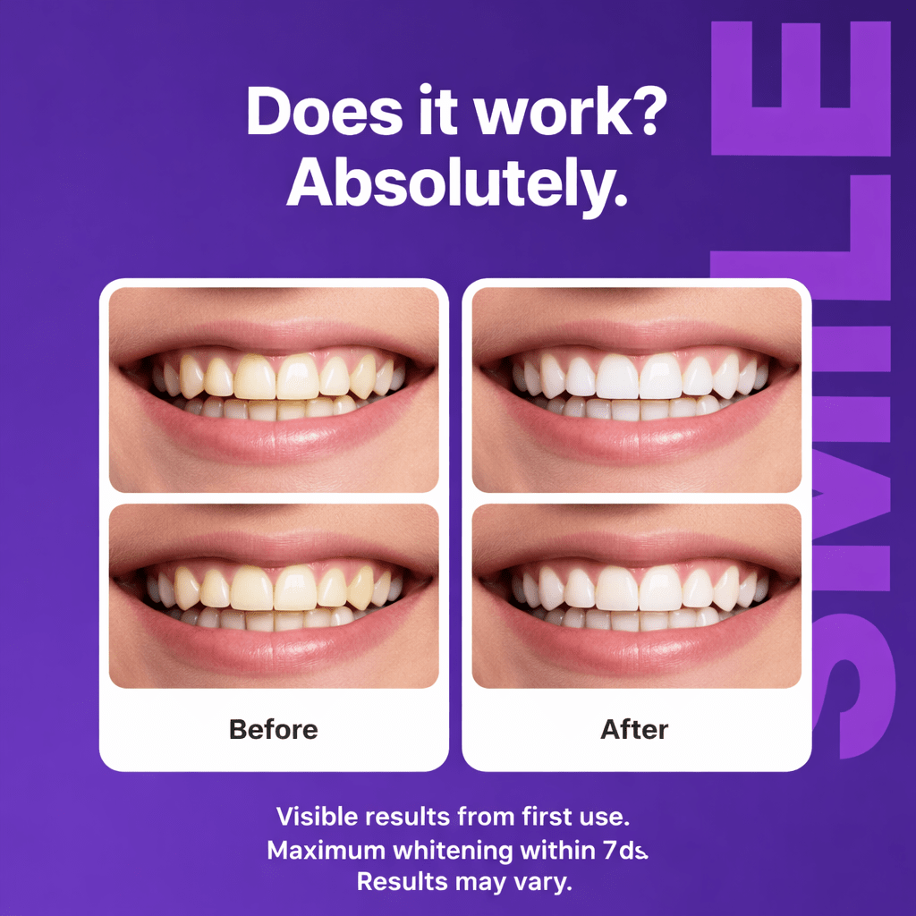 Purple Teeth Whitening Strips - Heath Insider