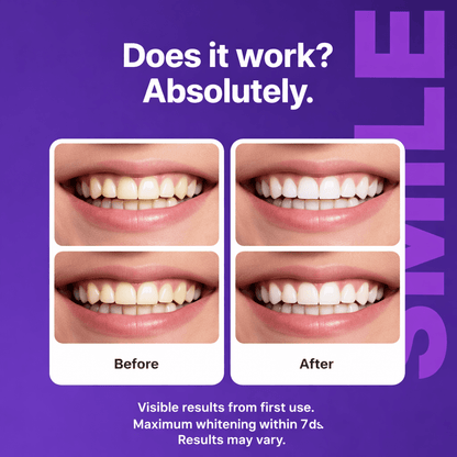 Purple Teeth Whitening Strips - Heath Insider